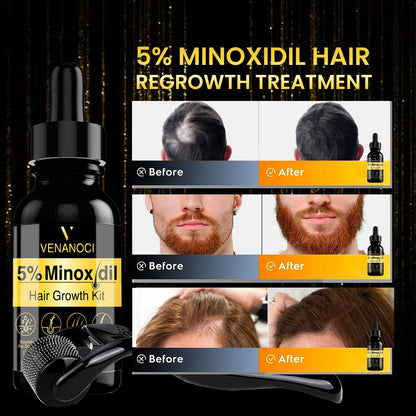 5% Minoxidil for Men and Women kit, Hair Growth Serum with Roller, Biotin Hair Growth Oil Hair Regrowth Treatment for Scalp Hair Loss Hair Thinning Natural Hair Growth for Longer Fuller Healthier Hair